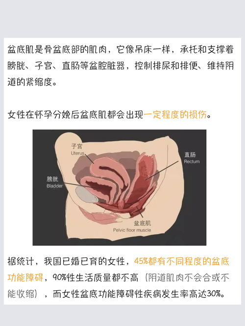 盆底肌训练仪到底是怎么的呢