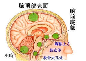 卵黄囊瘤恶性能治好吗