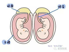 想要生个双胞胎怎么做