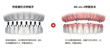 沈阳的康贝佳种植牙技术怎么样，在哪里！