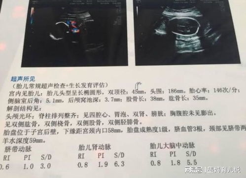 彩超孕囊比实际天数少是怎么回事