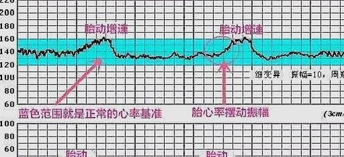 孕期胎儿有缺氧现象怎么办？