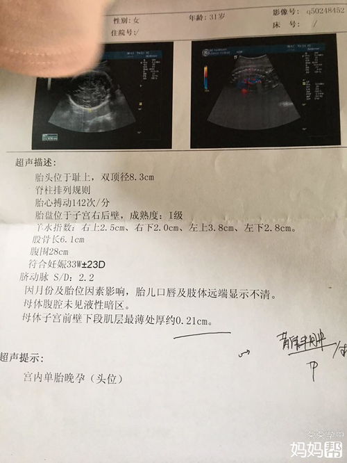 怀孕不到一个月能看到孕囊吗？