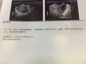 怀孕不到一个月能看到孕囊吗？