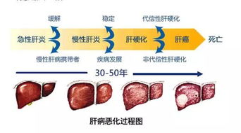 乙肝影响寿命吗？