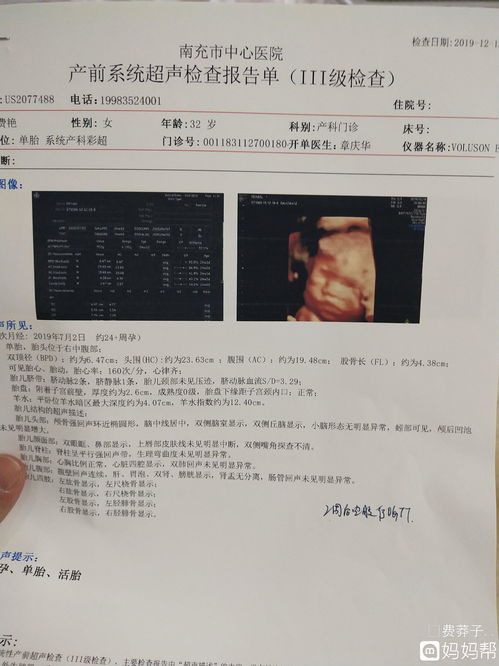 宝宝心肌损伤为什么要查心脏彩超