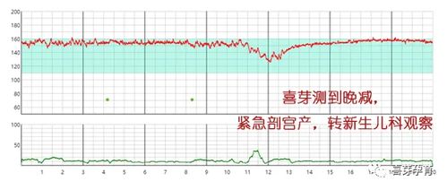 为什么做胎心监护缺氧的有那么多