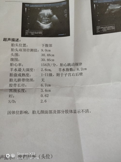 怀孕35周羊水深度多少正常