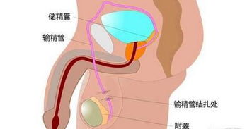 男性结扎完以后会肾虚吗