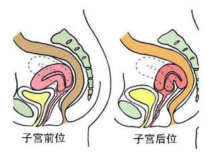 可以判断怀孕的好孕信号有哪些呢