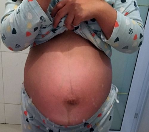 怀孕31周胎心是多少是正常