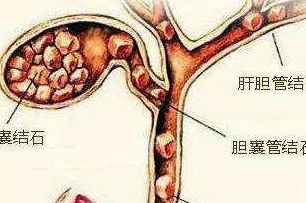 尿路感染能吃鹿茸吗