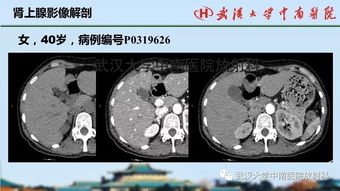 卵巢癌患者能保留生育功能吗？
