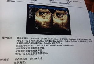 怀孕30周胎儿发育标准数据