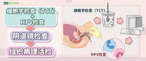 宫颈tct检查要多少钱