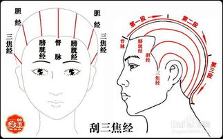 头疼刮痧刮哪个部位图片