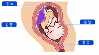 帆状胎盘可以多走动吗孕妇