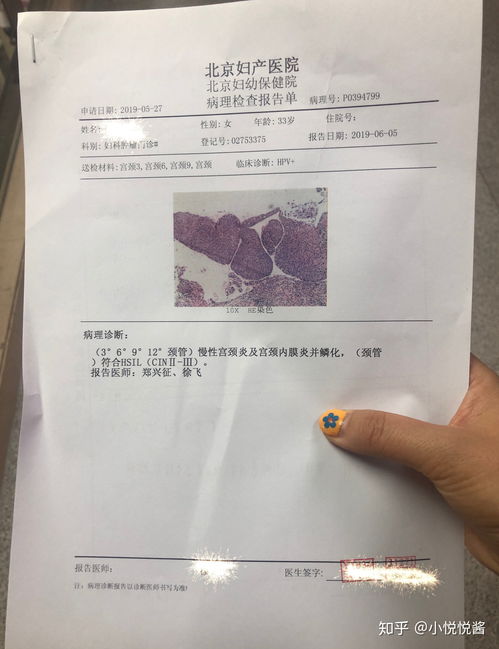 hpv 33阳性严重吗？如何根治