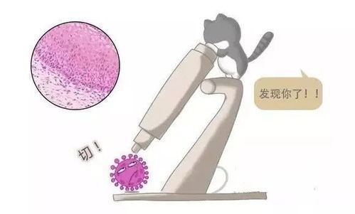 hpv 33阳性严重吗？如何根治