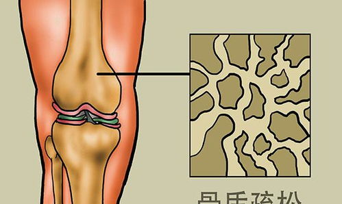 孕期补钙真的有必要吗？