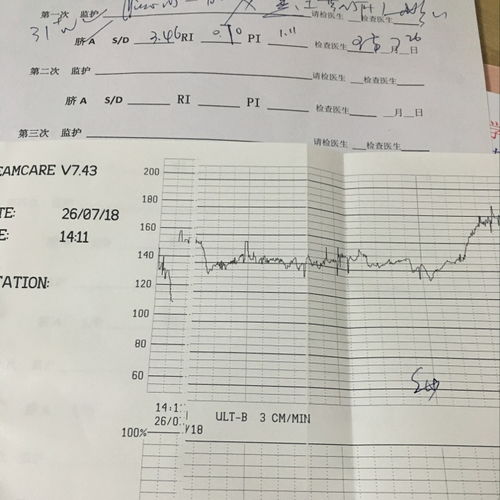 孕晚期胎心监护宫缩压多少正常