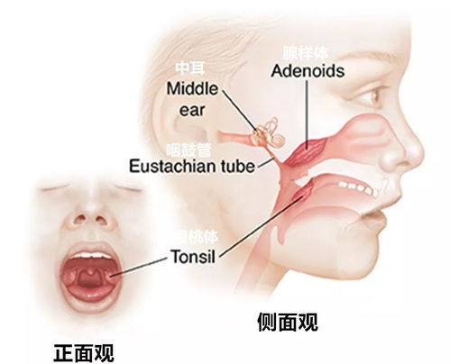 打鼾声音是嘴巴还是鼻子发出来的