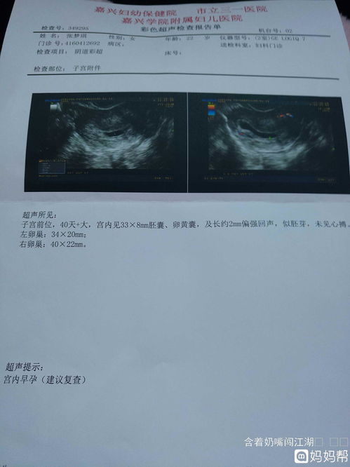 B超检查一定要早上去做吗？