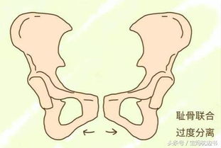 耻骨分离孕期怎么缓解