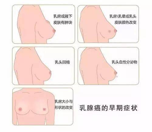 腋窝疼怎么 回事