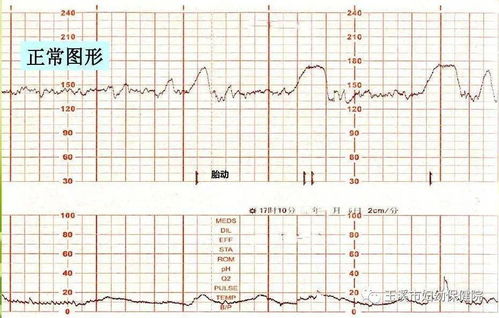 今天去做了产检，医生说宝宝胎心有时候强有时候弱不规律是怎么回事？