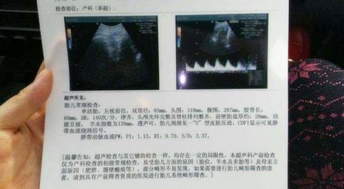 孕期b超检查最好不超过4次吗