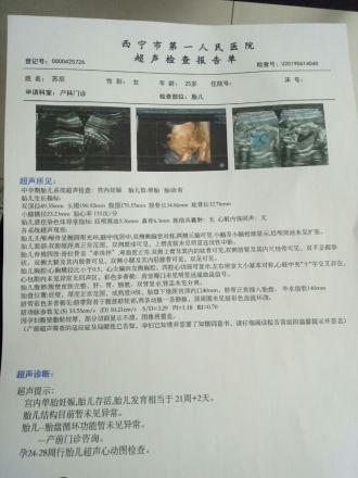 关于怀孕40天b超检查只见胎囊和卵黄囊，其他什么没有正常吗？的问题