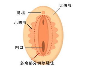 宫腔积血会有什么症状