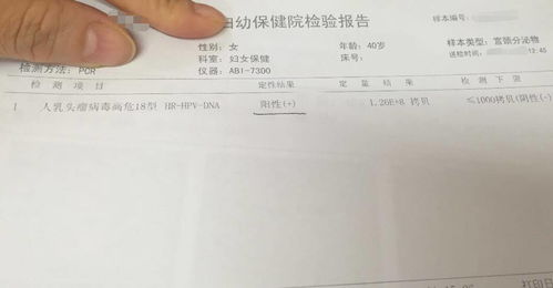 婚检能查出来皮肤病吗