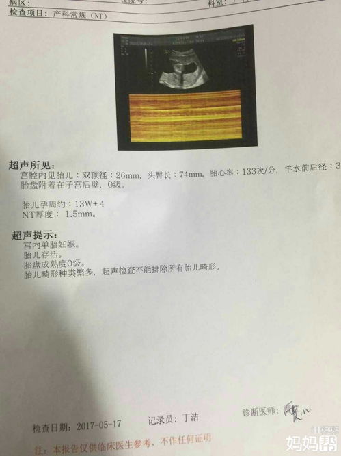 怀孕初期孕囊的位置偏左，这有在医院检查的报告单，请帮我看下