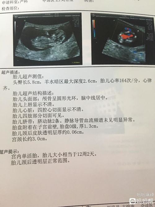 十天小孩黄疸16.2算不算高