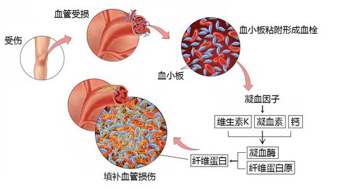 孕妇脑出血是怎么回事儿