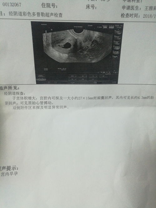 怀孕7周可以看到孕囊吗