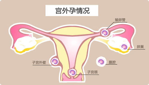 月经周期延长了怎么办