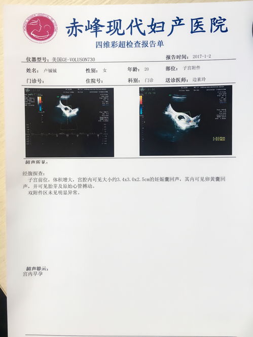 生化了再次怀孕有影响吗