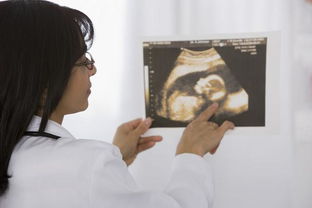 根据孕囊形状预测胎儿性别准吗？