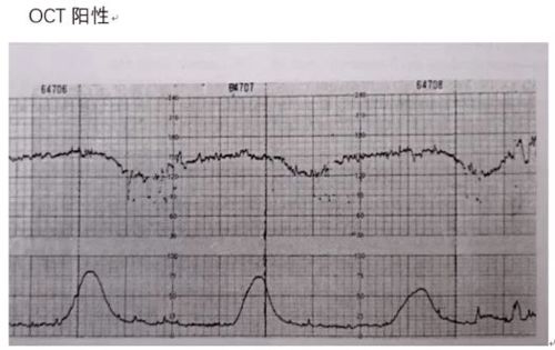 胎心监护只有7分!怎么办?