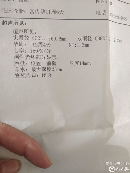 宝宝比实际停经月数大，有问题不？？