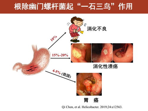 幽门螺旋杆菌牛奶可以喝吗?