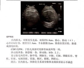 孕晚期37周羊水指数正常范围