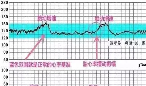 孕38周，胎心监护160左右，是否偏快？什么原因？