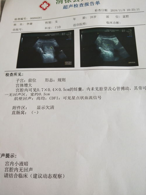 35周股骨长正常范围是多少