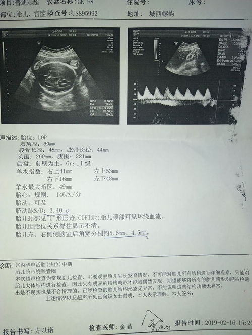 怀孕15周+5天，羊水暗区最大前后径27mm。正常吗？