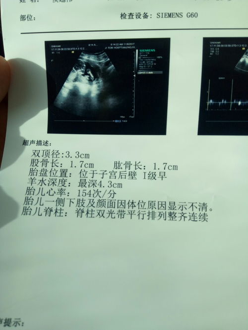 怀孕15周+5天，羊水暗区最大前后径27mm。正常吗？