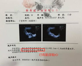 怀孕七个月女胎儿图是怎样的